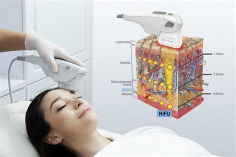 Embracing the Magic: How Ultrasound Can Enhance Your Skincare Routine